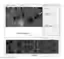 Fig. 16 - Global and semi-global registration for image-based bronchoscopy guidance