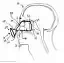 Fig. 01 - SURGICAL SHIELD FOR SOFT TISSUE PROTECTION