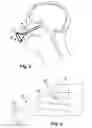 Fig. 04 - SURGICAL SHIELD FOR SOFT TISSUE PROTECTION