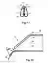 Fig. 07 - SURGICAL SHIELD FOR SOFT TISSUE PROTECTION