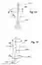 Fig. 09 - SURGICAL SHIELD FOR SOFT TISSUE PROTECTION