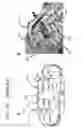 Fig. 43 - Methods and devices to decrease tissue trauma during surgery