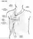Fig. 97 - Methods and devices to decrease tissue trauma during surgery