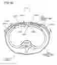 Fig. 99 - Methods and devices to decrease tissue trauma during surgery
