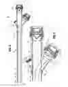 Fig. 06 - Endoluminal access device