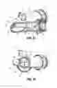 Fig. 08 - Endoluminal access device