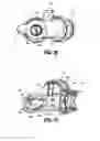 Fig. 17 - Endoluminal access device