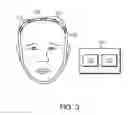 Fig. 04 - Wireless, implantable electro-encephalography system