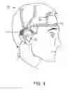 Fig. 05 - Wireless, implantable electro-encephalography system