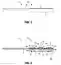 Fig. 05 - Lancet device with flexible cover