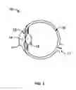 Fig. 02 - Apparatus and method for non-invasively detecting diseases that affect structural properties in biological tissues