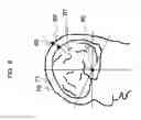 Fig. 09 - Biological optical measurement instrument and reference image display method