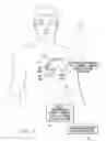 Fig. 02 - Systems and methods for tracking stroke volume using hybrid impedance configurations employing a multi-pole implantable cardiac lead