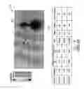 Fig. 06 - Systems and methods for tracking stroke volume using hybrid impedance configurations employing a multi-pole implantable cardiac lead