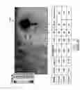 Fig. 08 - Systems and methods for tracking stroke volume using hybrid impedance configurations employing a multi-pole implantable cardiac lead