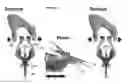 Fig. 06 - Systems and methods for MRI guided trans-orifice and transperineal intervention apparatus with adjustable biopsy needle insertion