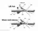 Fig. 07 - Systems and methods for MRI guided trans-orifice and transperineal intervention apparatus with adjustable biopsy needle insertion