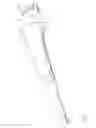 Fig. 02 - Cutter drive assembly for biopsy device