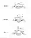 Fig. 02 - DEUTERATED WATER AND RIBOFLAVIN SOLUTION FOR EXTENDING SINGLET OXYGEN LIFETIMES IN TREATMENT OF OCULAR TISSUE AND METHOD OF USE