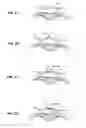 Fig. 03 - DEUTERATED WATER AND RIBOFLAVIN SOLUTION FOR EXTENDING SINGLET OXYGEN LIFETIMES IN TREATMENT OF OCULAR TISSUE AND METHOD OF USE