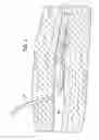 Fig. 02 - Methods for preparing a heat exchange catheter system and for heating and/or cooling a subject's body