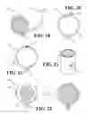 Fig. 05 - Implantable device for controlled dissolution and diffusion of low solubility drug