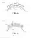 Fig. 06 - Implantable device for controlled dissolution and diffusion of low solubility drug