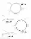 Fig. 07 - Implantable device for controlled dissolution and diffusion of low solubility drug