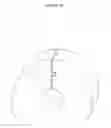 Fig. 07 - Methods and devices for preventing catheter related urinary tract infections