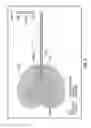 Fig. 04 - Dual antenna microwave resection and ablation device, system and method of use