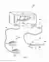 Fig. 02 - Fine dissection electrosurgical device