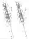 Fig. 08 - T-fastener suture delivery system