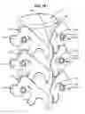 Fig. 04 - LOW PROFILE SPINAL PROSTHESIS INCORPORATING A CANNULATED BONE ANCHOR HAVING A DEFLECTABLE POST AND A COMPOUND SPINAL ROD