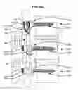 Fig. 19 - LOW PROFILE SPINAL PROSTHESIS INCORPORATING A CANNULATED BONE ANCHOR HAVING A DEFLECTABLE POST AND A COMPOUND SPINAL ROD
