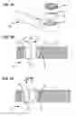Fig. 22 - LOW PROFILE SPINAL PROSTHESIS INCORPORATING A CANNULATED BONE ANCHOR HAVING A DEFLECTABLE POST AND A COMPOUND SPINAL ROD