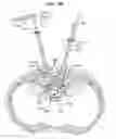 Fig. 40 - LOW PROFILE SPINAL PROSTHESIS INCORPORATING A CANNULATED BONE ANCHOR HAVING A DEFLECTABLE POST AND A COMPOUND SPINAL ROD