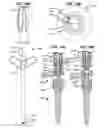 Fig. 41 - LOW PROFILE SPINAL PROSTHESIS INCORPORATING A CANNULATED BONE ANCHOR HAVING A DEFLECTABLE POST AND A COMPOUND SPINAL ROD