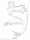 Fig. 15 - Method and Apparatus for Ablation of Benign, Pre-Cancerous and Early Cancerous Lesions That Originate Within the Epithelium and are Limited to the Mucosal Layer of the Gastrointestinal Tract
