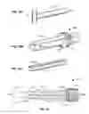 Fig. 28 - Method and Apparatus for Ablation of Benign, Pre-Cancerous and Early Cancerous Lesions That Originate Within the Epithelium and are Limited to the Mucosal Layer of the Gastrointestinal Tract