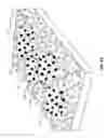 Fig. 33 - Method and Apparatus for Ablation of Benign, Pre-Cancerous and Early Cancerous Lesions That Originate Within the Epithelium and are Limited to the Mucosal Layer of the Gastrointestinal Tract
