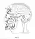 Fig. 02 - METHODS USING TRIGEMINAL NERVE STIMULATION TO TREAT NEUROLOGICAL DISEASES