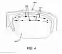 Fig. 05 - SPECTACLES FOR LIGHT THERAPY