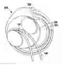 Fig. 01 - Electrode cable wrap