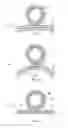Fig. 02 - METHOD AND SYSTEM FOR DELIVERY OF COATED IMPLANTS