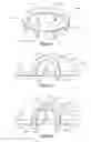 Fig. 03 - Scaffold device for preventing tissue trauma
