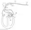 Fig. 01 - Method of post-operative adjustment for mitral valve implant