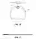 Fig. 03 - Method of post-operative adjustment for mitral valve implant