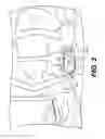 Fig. 04 - Method of post-operative adjustment for mitral valve implant