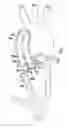 Fig. 01 - Implantation device