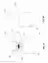 Fig. 04 - Implantation device